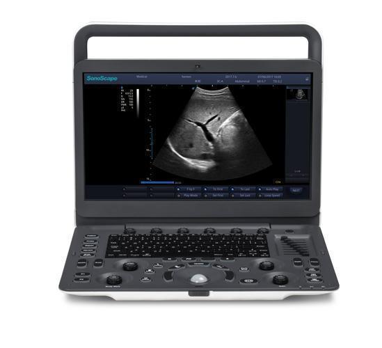 Sonoscape E1: il futuro dell’ecografia portatile con intelligenza artificiale integrata